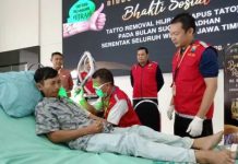 Polda Jatim Gelar Program Hapus Tato Gratis, Warga Antusias Mendaftar