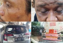 BIADAB! Wartawan Disekap, Dianiaya, Dirampok dan Diperas Mafia BBM dan Tambang Ilegal di Sijunjung