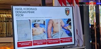 Tubuh Andrie Yunus Luka Bakar 20%, Kornea Mata Rusak 40% Akibat Air Keras