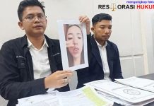 Praktik Facelift Ilegal, Eks Finalis Puteri Indonesia Riau Jadi Tersangka