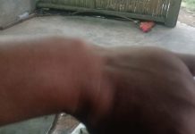 BOM! KORBAN PENGEROYOKAN BANYUASIN BONGKAR DUGAAN PUNGLI RP5,5 JUTA KE OKNUM POLISI. “BIAR NAIK SIDIK”