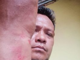 LP Mandek 6 Bulan, Korban Pengeroyokan di Banyuasin Mengadu ke Mabes Polri: Penyidik Satreskrim Polres Banyuasin Diduga Minta Uang Rp 5 Juta