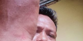 LP Mandek 6 Bulan, Korban Pengeroyokan di Banyuasin Mengadu ke Mabes Polri: Penyidik Satreskrim Polres Banyuasin Diduga Minta Uang Rp 5 Juta